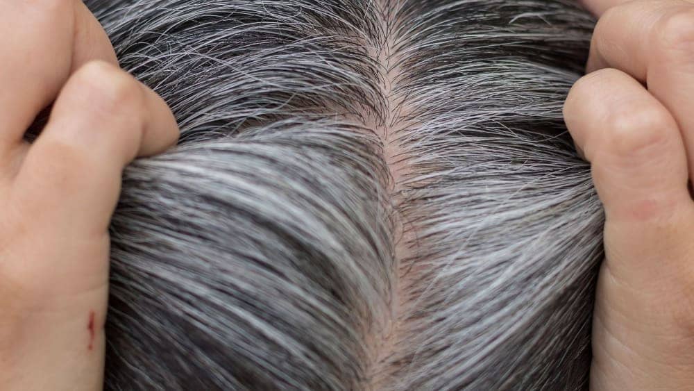 روند سفید شدن موها به طور معمول و طبیعی ، با افزایش سن آغاز میشود
